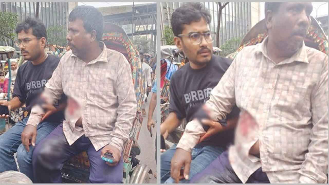 মতিঝিলে ব্যবসায়ীকে গুলি করে ১৭ হাজার ডলার ছিনতাই