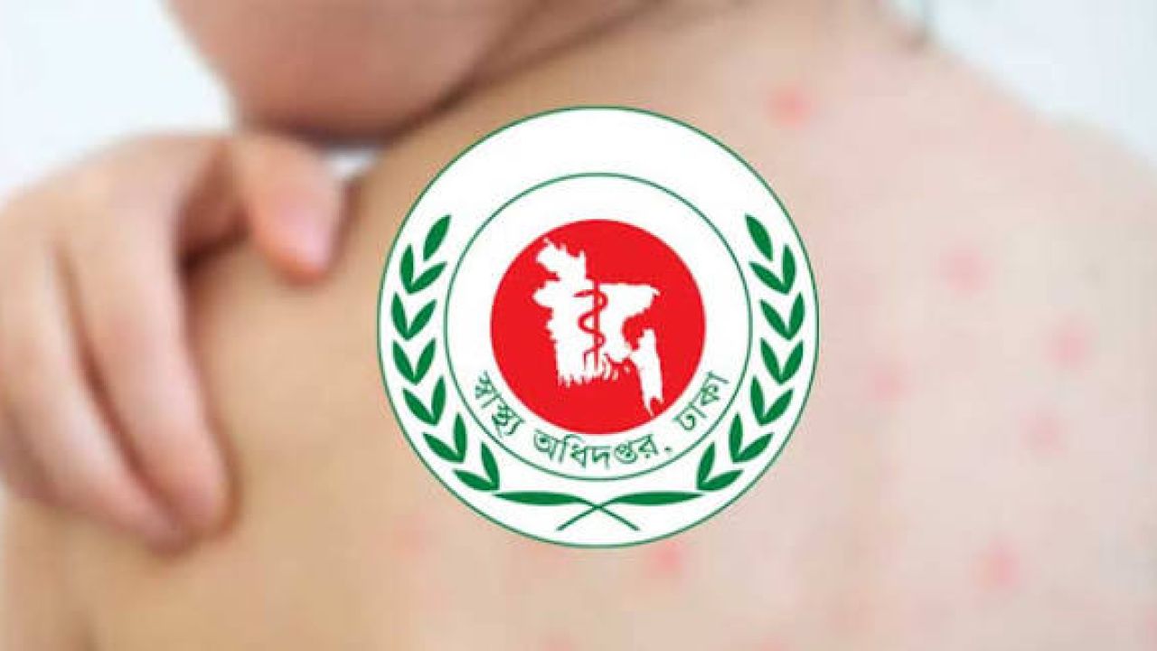 দেশে হামের প্রকোপ: ২৪ ঘণ্টায় ৮ জনের মৃত্যু