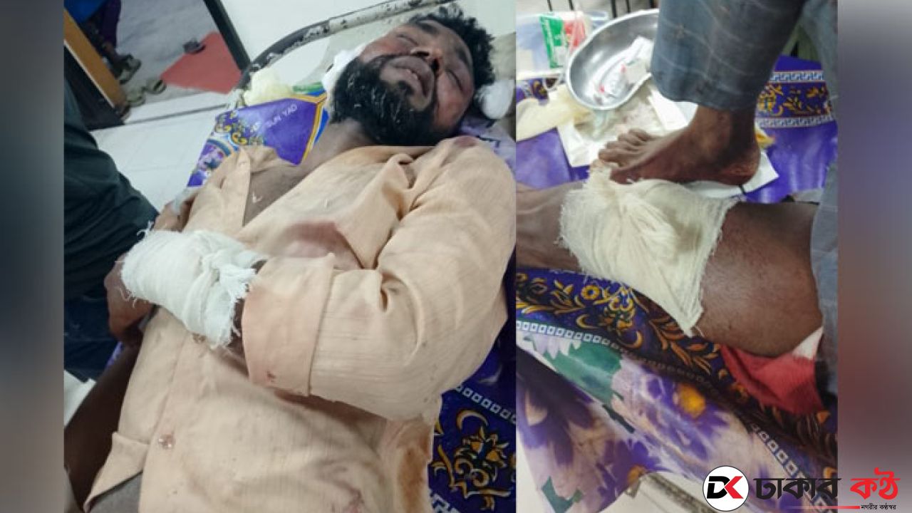 পরিকল্পিতভাবে ডেকে নিয়ে নির্যাতন করায় হাসপাতালে মৃত্যুর সঙ্গে লড়ছে কেরানীগঞ্জের বাপ্পি
